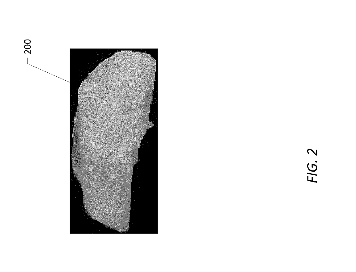 Nanosilica dispersion lost circulation material (LCM)