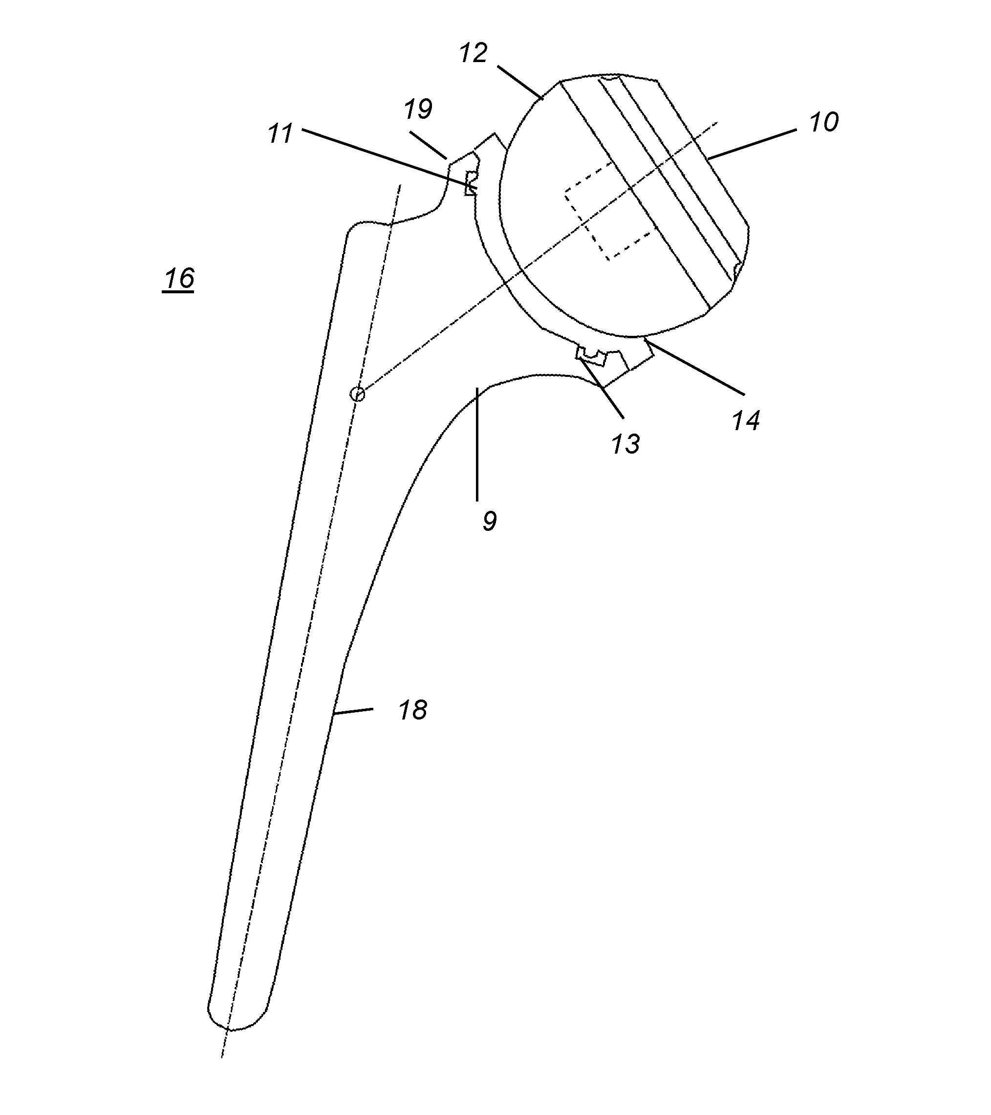 Reverse total hip replacement