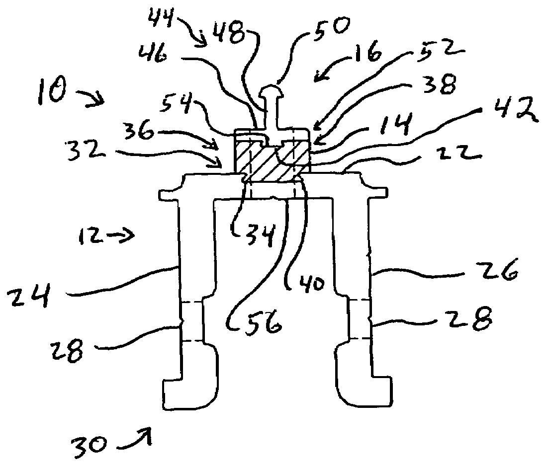 Thermally broken sunshade anchors