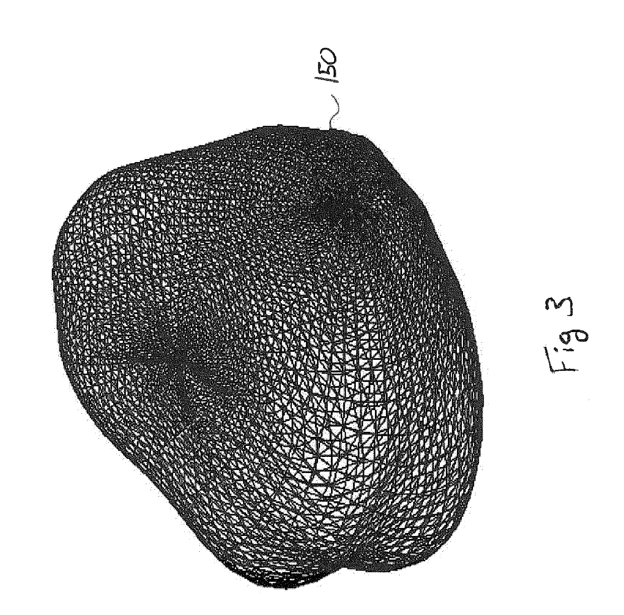 Apparatus for real-time 3D biopsy