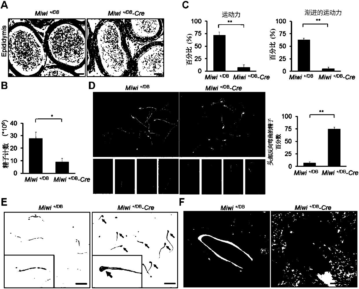 Method and kit for diagnosing male infertility caused by Piwil1 gene mutation