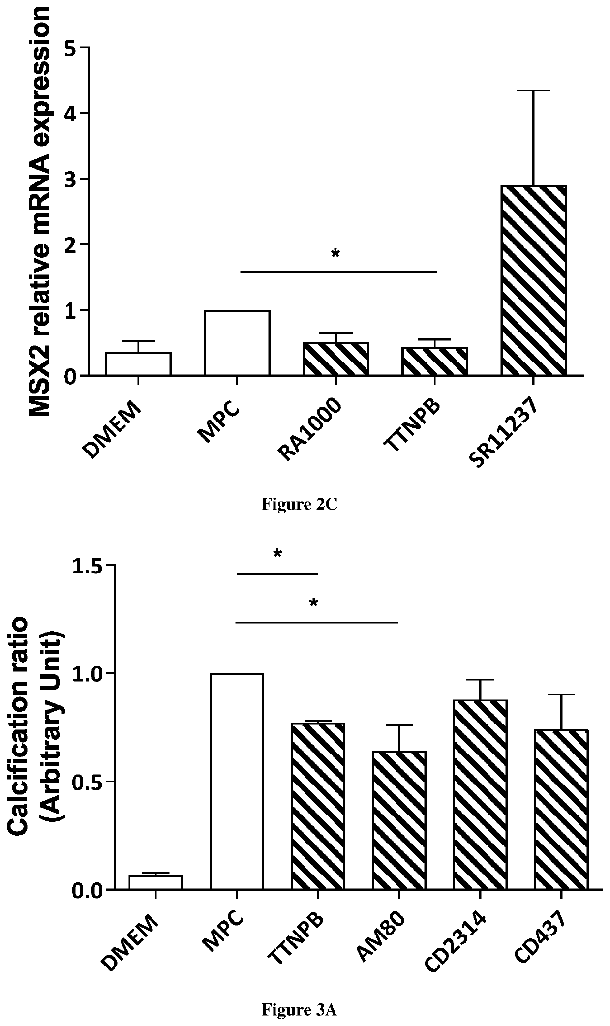 Use of retinoic acid receptor (RAR) agonists for reversing, preventing, or delaying calcification of aortic valve