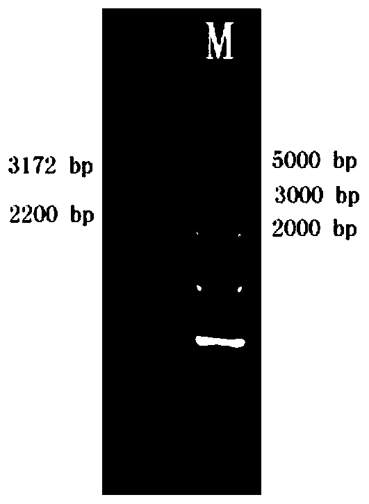 Method for producing recombinant human type II collagen single chain by Pichia pastoris