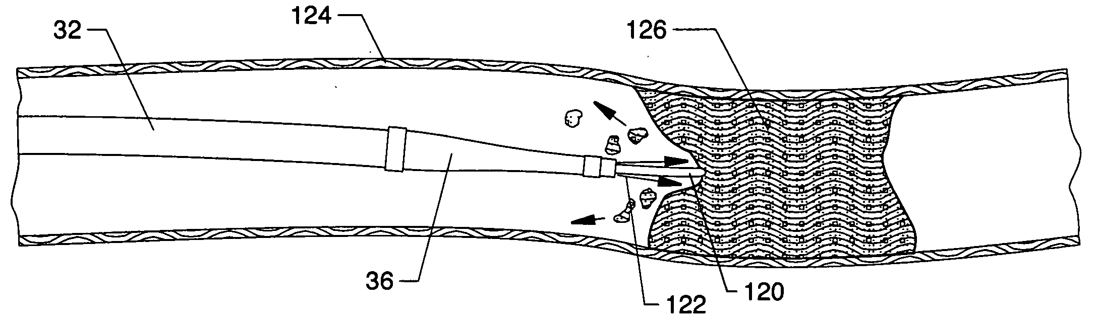 Forwardly directed fluid jet crossing catheter