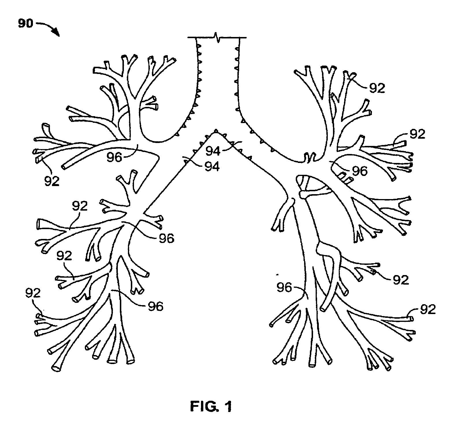 Energy delivery devices and methods