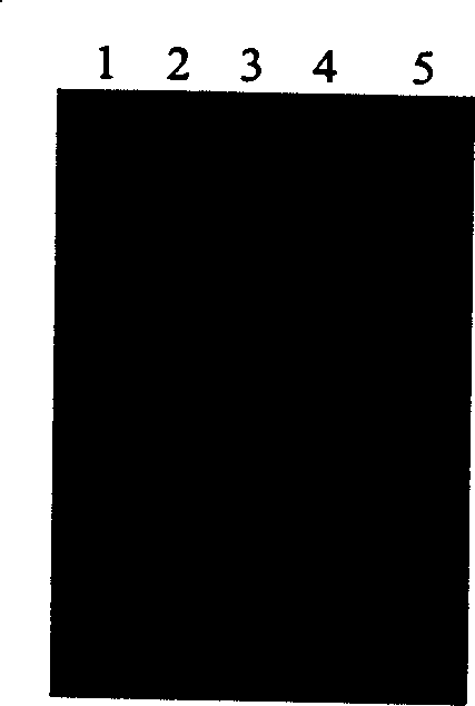 Tiantan remocined vaccine virus of IFN-alpha receptor gene (B8R) deletion and application thereof