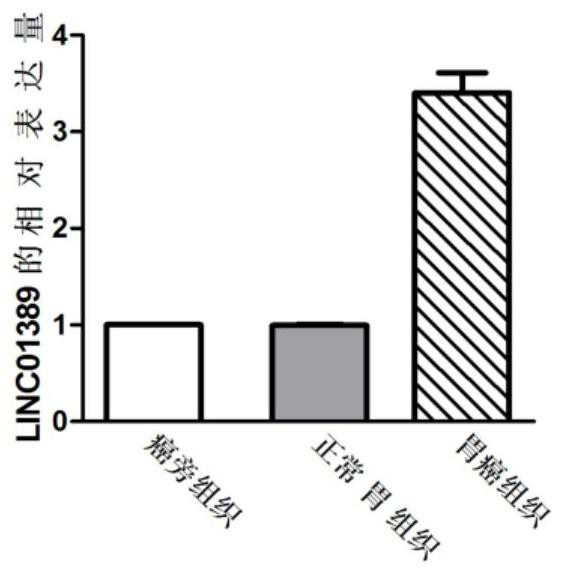 Application of linc01389 in the diagnosis and treatment of gastric cancer