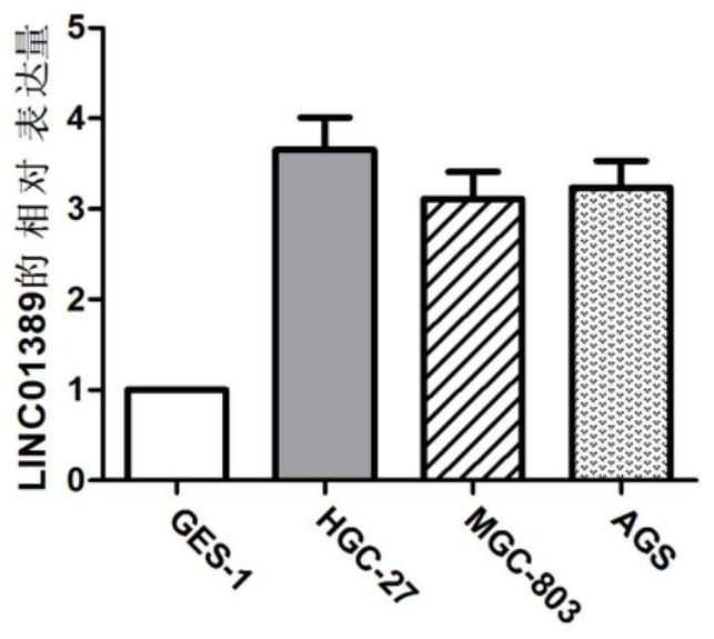 Application of linc01389 in the diagnosis and treatment of gastric cancer