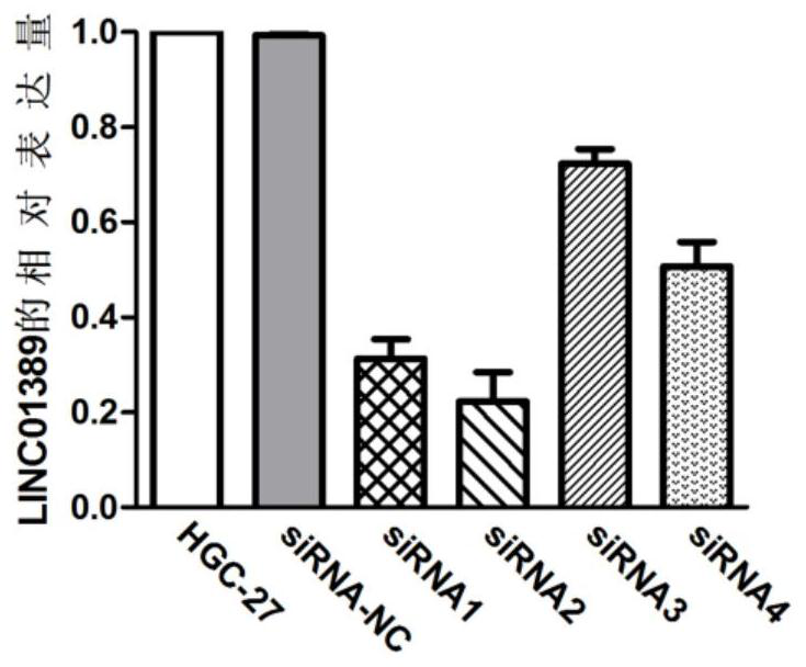 Application of linc01389 in the diagnosis and treatment of gastric cancer