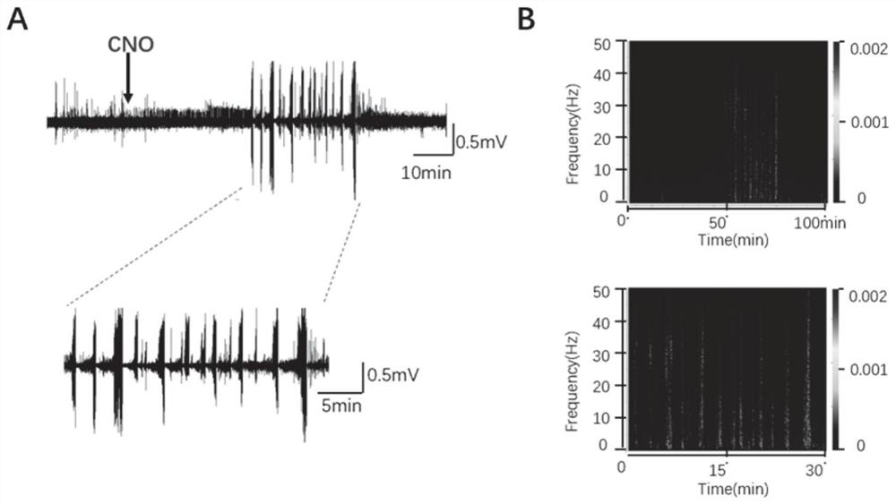 Chemical heredity epilepsy persistent state disease animal model and construction method and application thereof