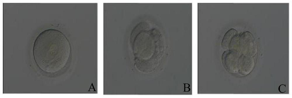 Application of human chorionic gonadotropin in preparation of pregnancy assisting medicine for patients with premature ovarian insufficiency