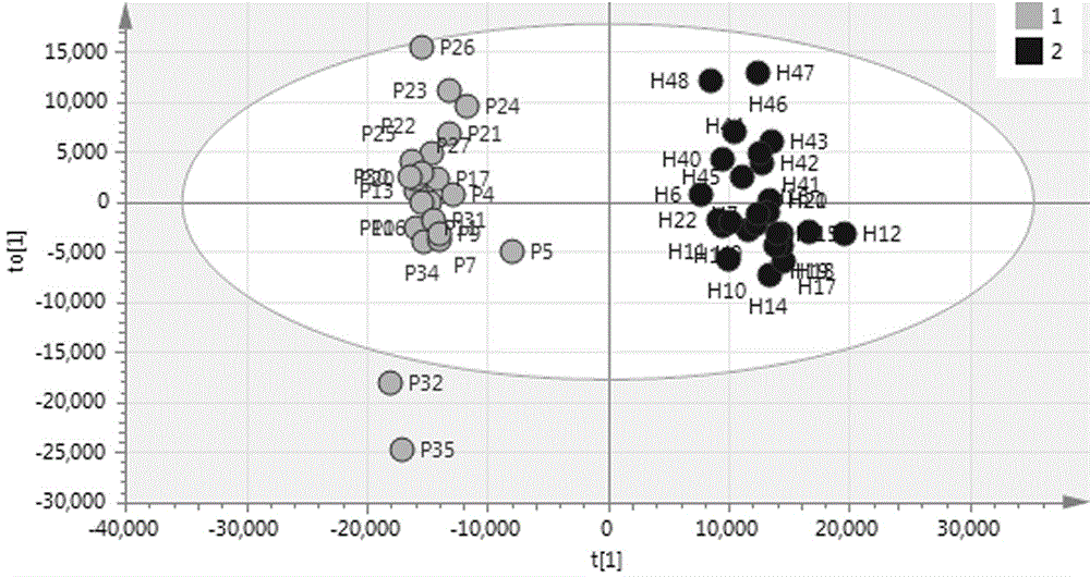 Method for determining and screening differential metabolites of laryngeal cancer serum based on inverted phase chromatography time-of-flying mass spectrum