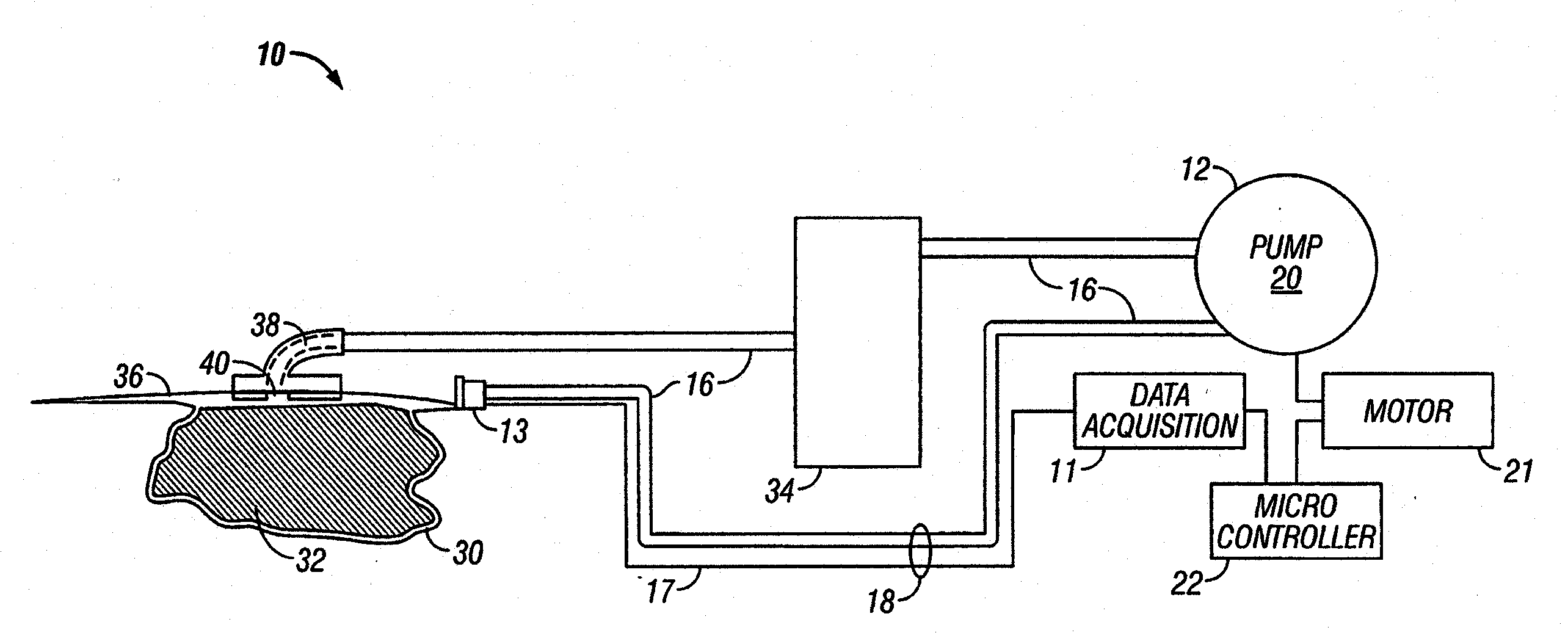 System for combined transcutaneous blood gas monitoring and negative pressure wound treatment