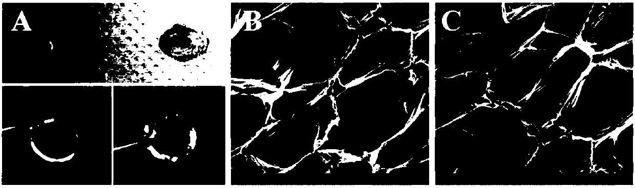 MMP-8 responsive intelligent periodontal drug controlled release hydrogel material and application thereof