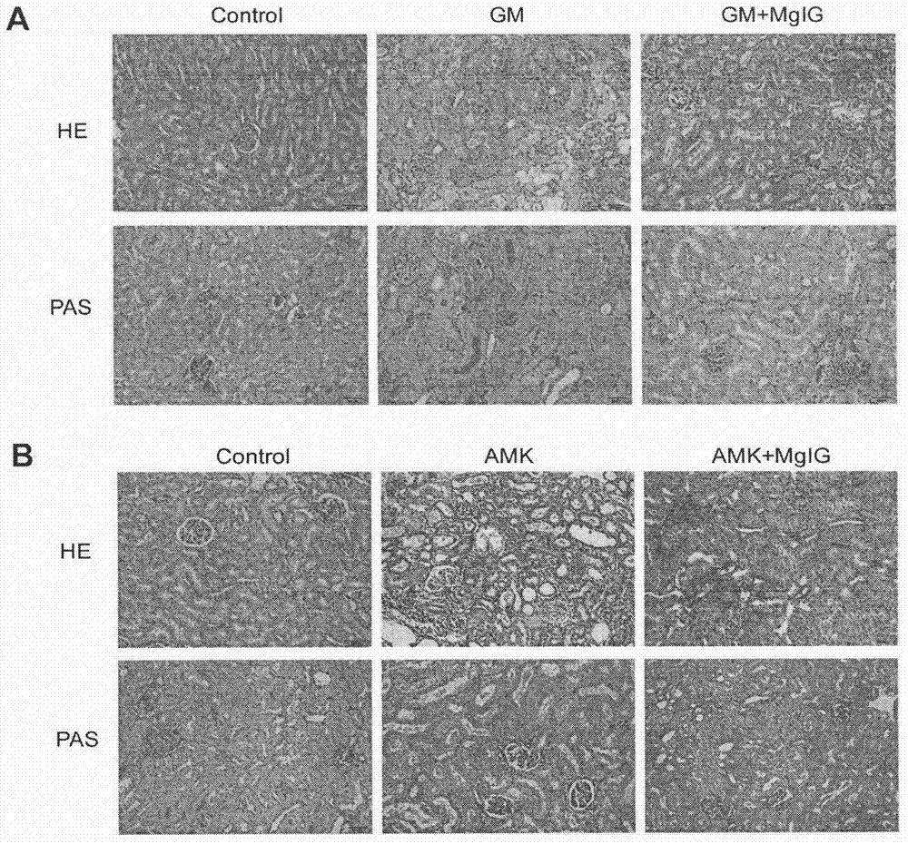 Application of MgIG (magnesium isoglycyrrhizinate) in preparing treatment drug for relieving renal injury caused by aminoglycoside antibiotics