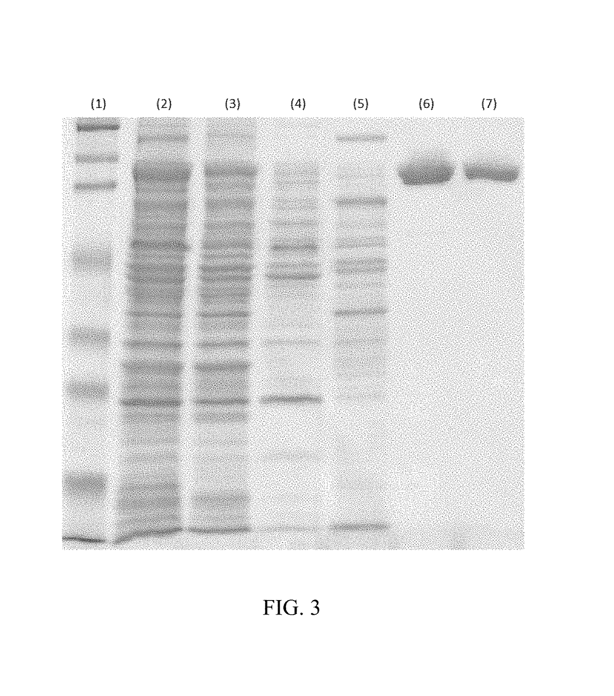 Production of high purity chondroitinase ABC