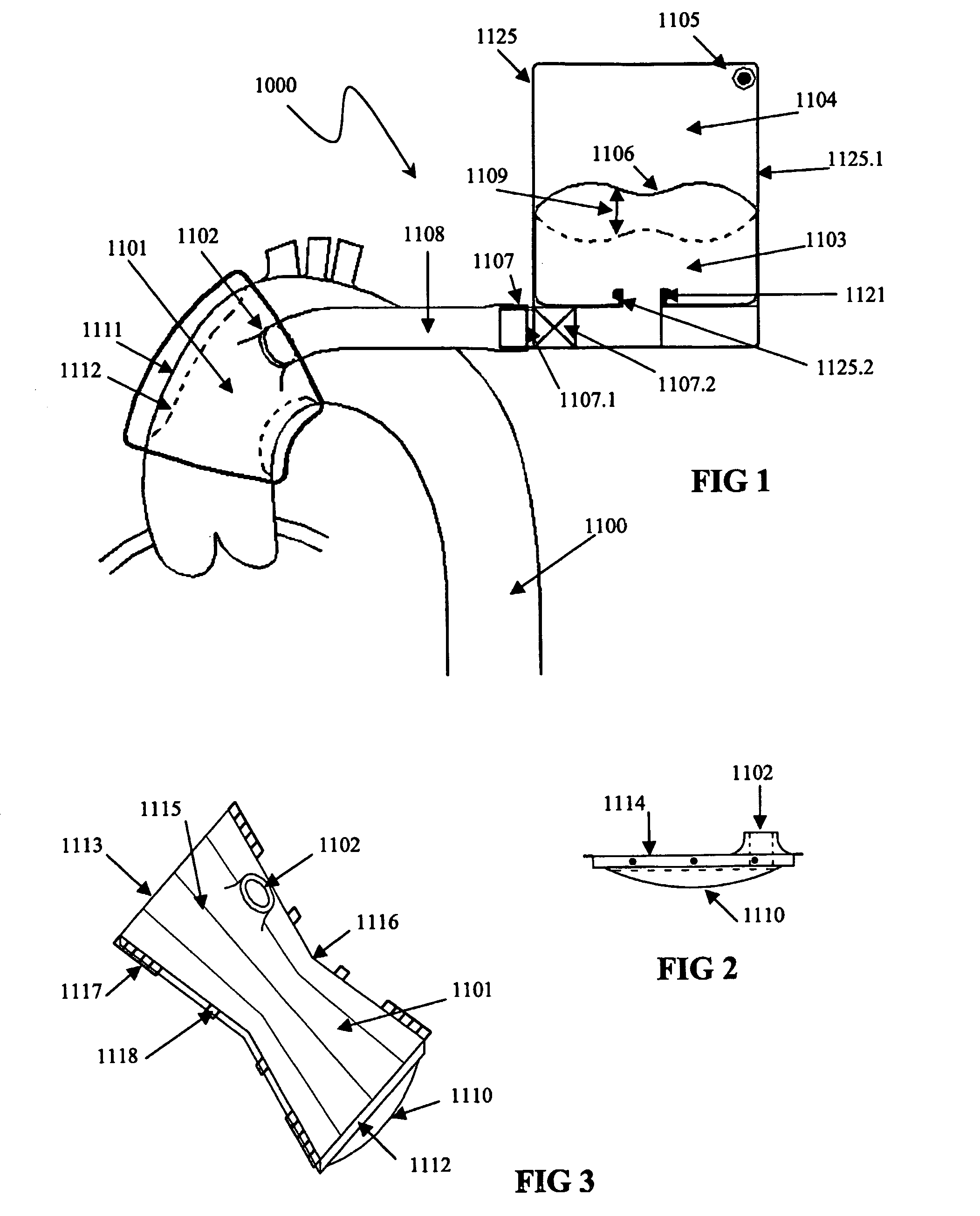 Vessel or sac wall treatment and a cardiac assist device