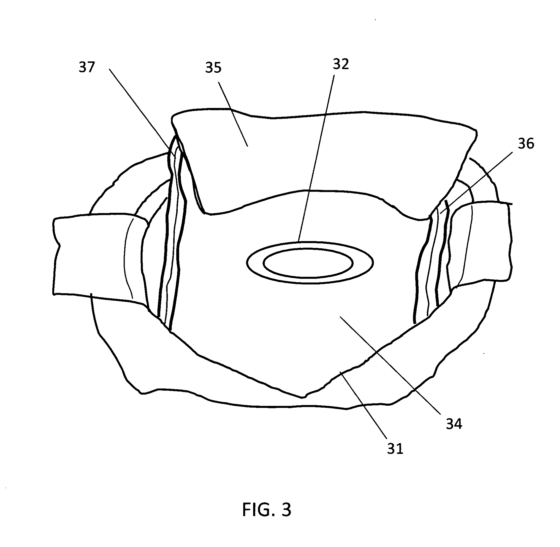 Method and instrument for occlusion of uterine blood vessels