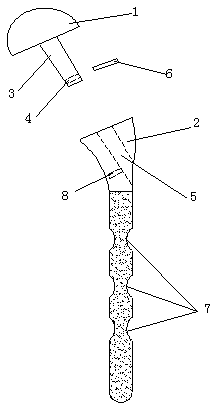 a shoulder prosthesis