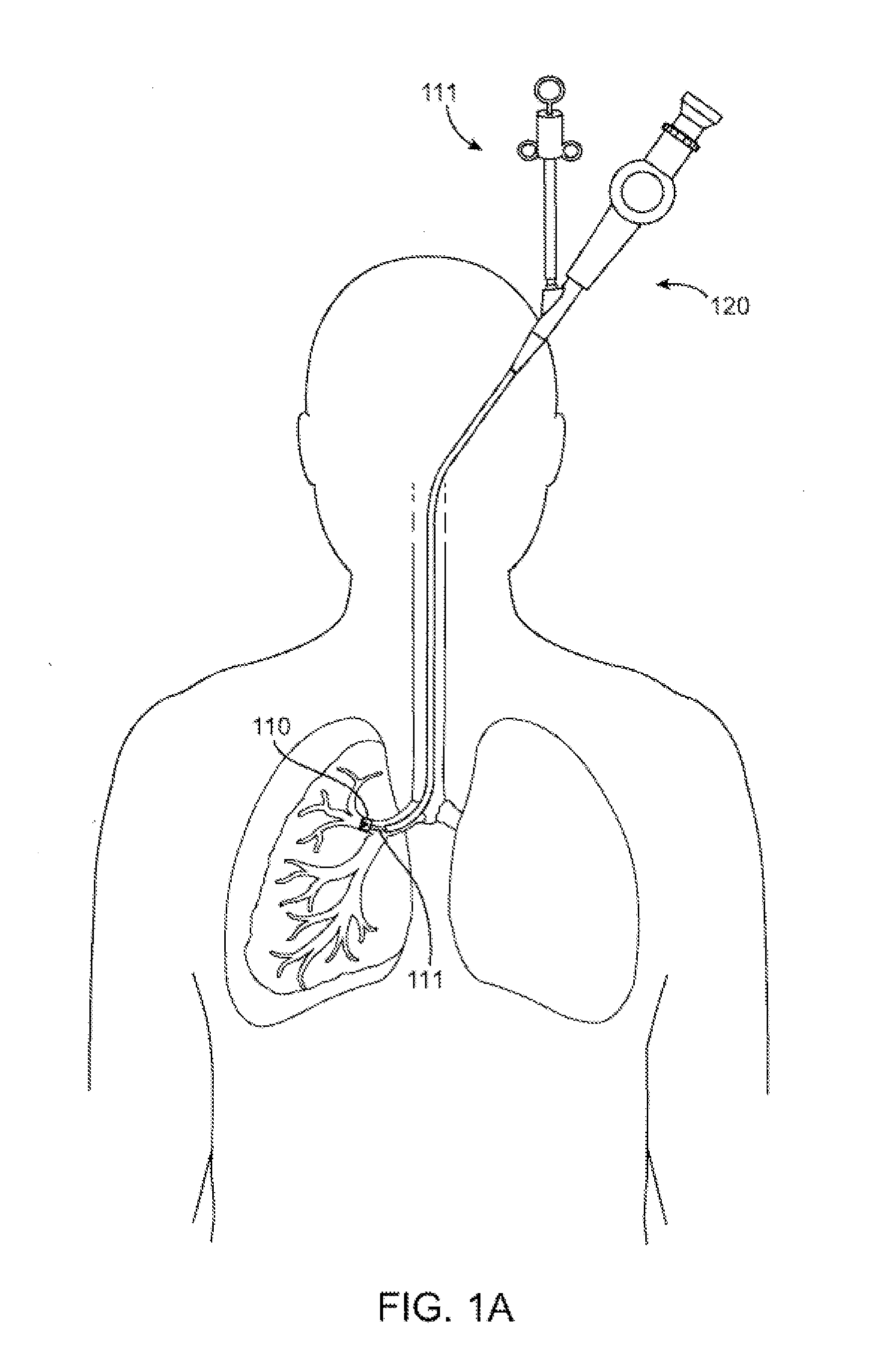 Bronchial isolation devices for placement in short lumens