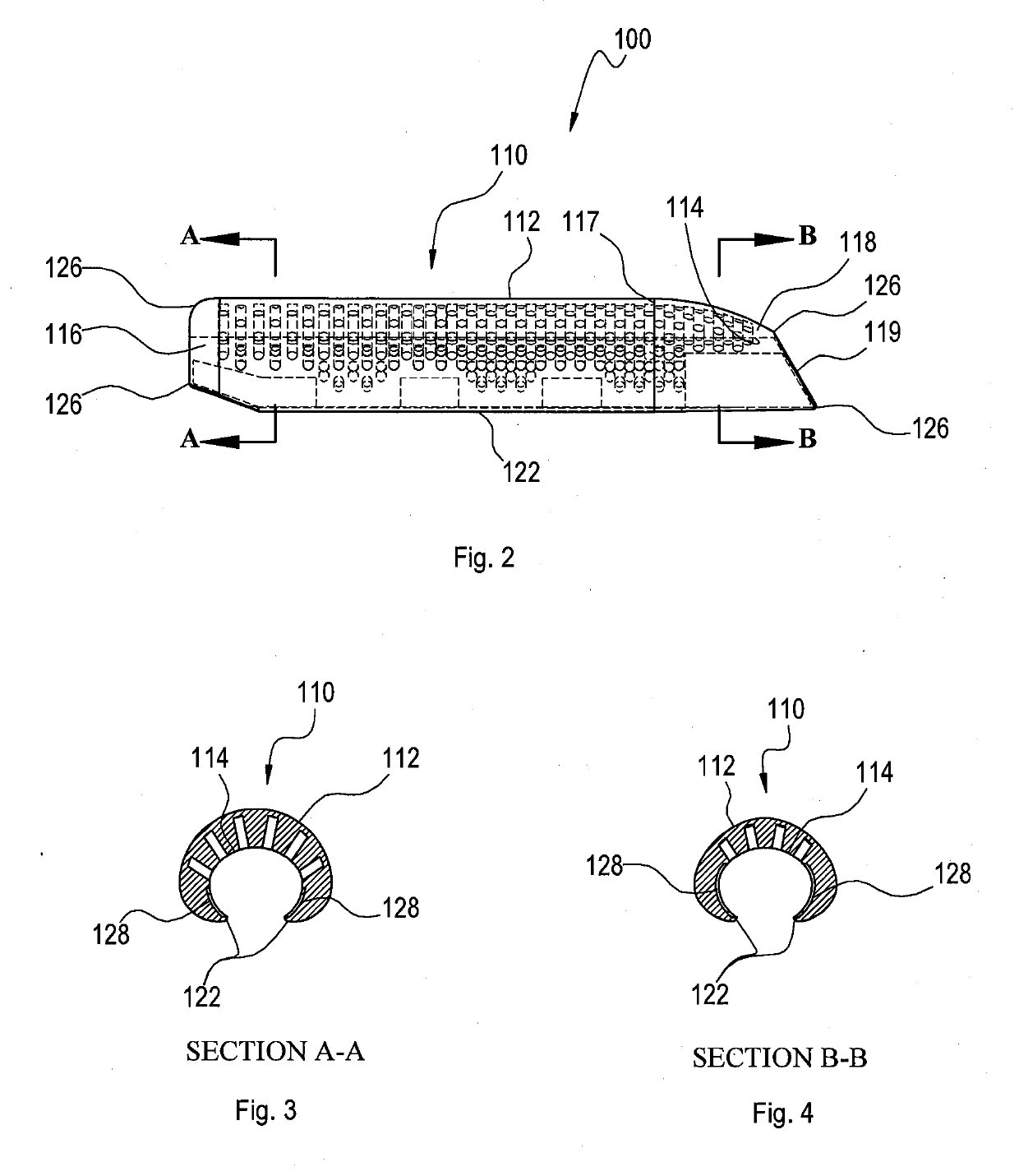 Implants that facilitate tissue expansion