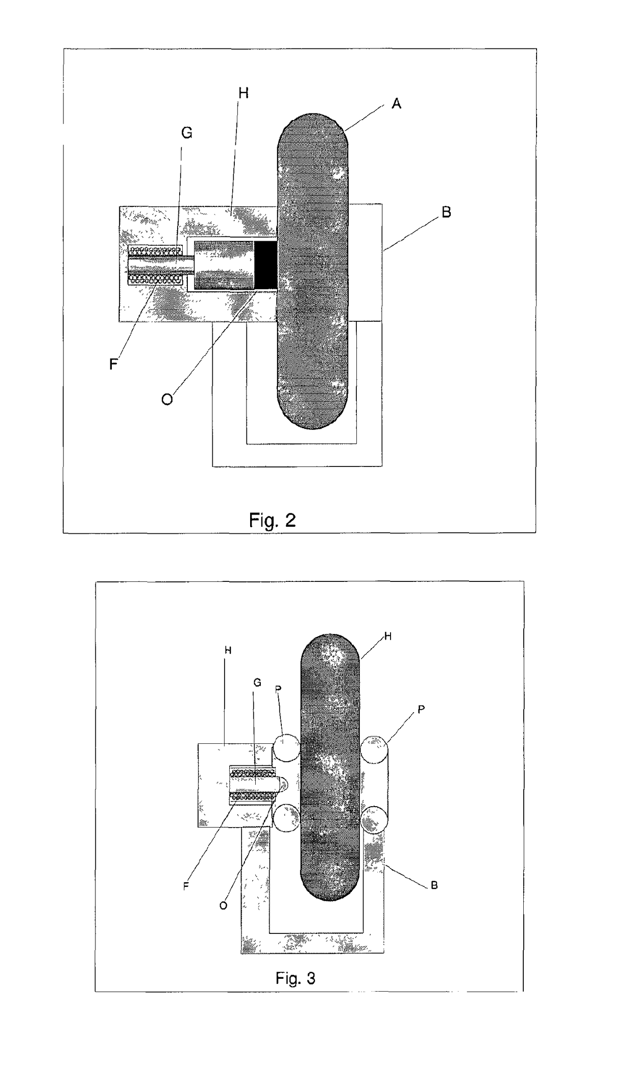 Sensor device for sensing body fluid density and/or membrane resistance