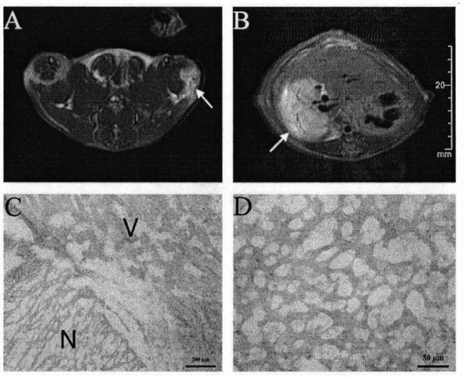 Magnetic resonance imaging contrast agent