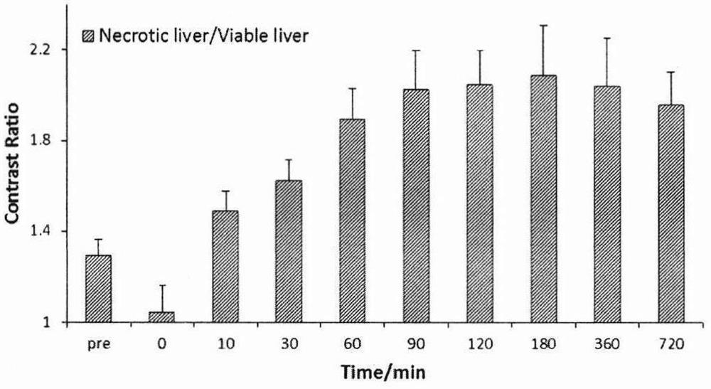 Magnetic resonance imaging contrast agent