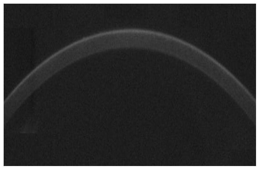 Method for extracting cornea contour through cornea dynamic deformation video based on Otsu algorithm