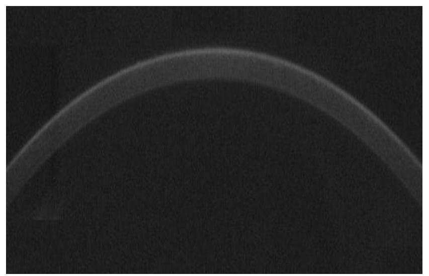 Method for extracting cornea contour through cornea dynamic deformation video based on Otsu algorithm