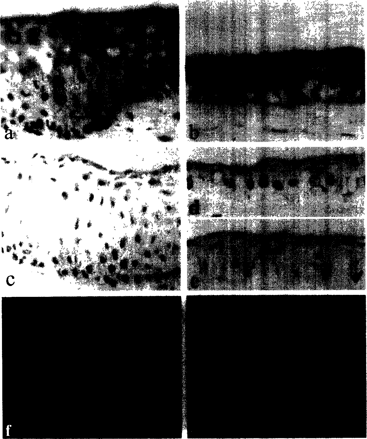 Human corneal limbal stem cell tissue engineering product nourished by fibroblast and preparing process thereof