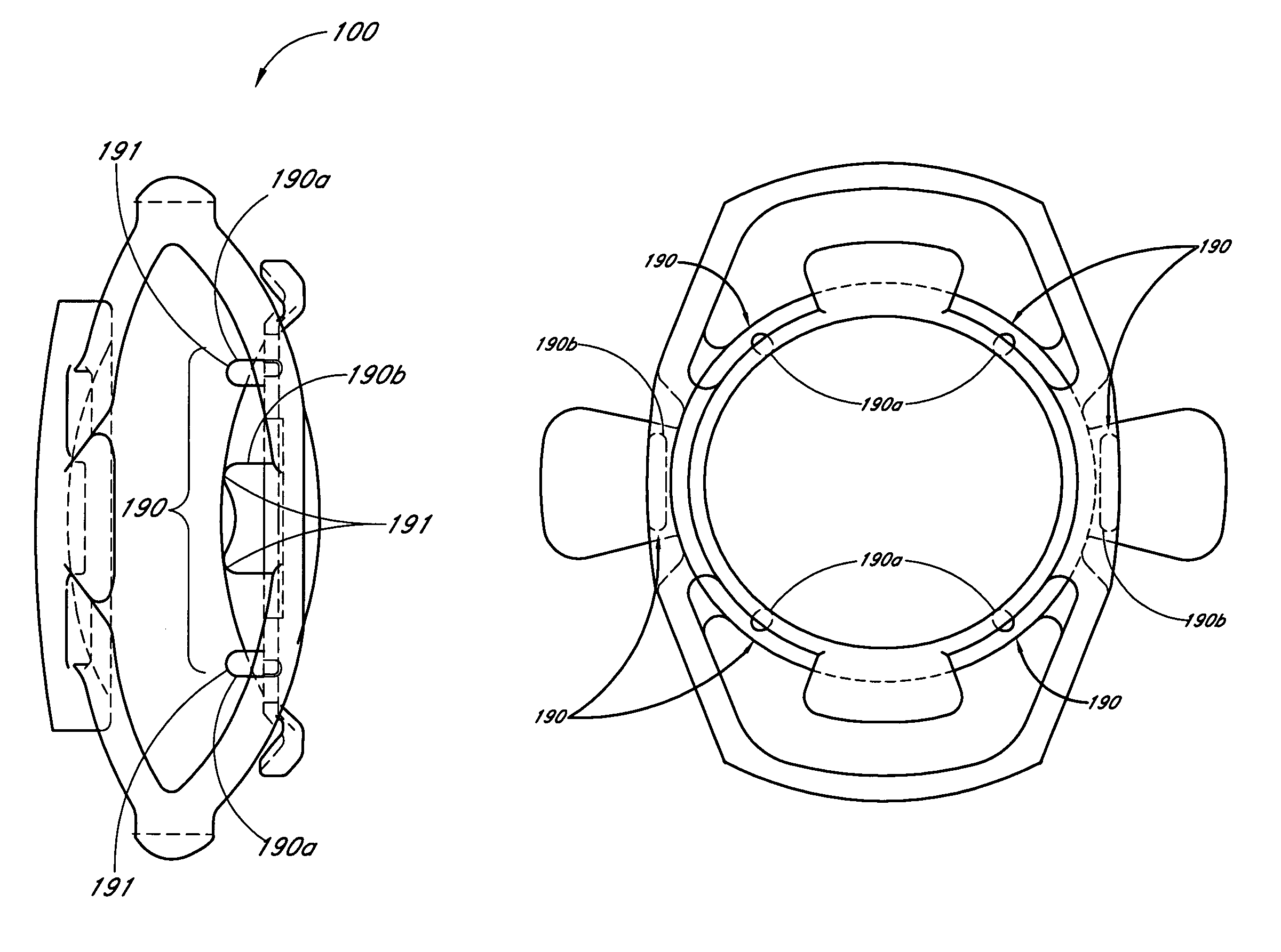 Accommodating intraocular lens system with separation member