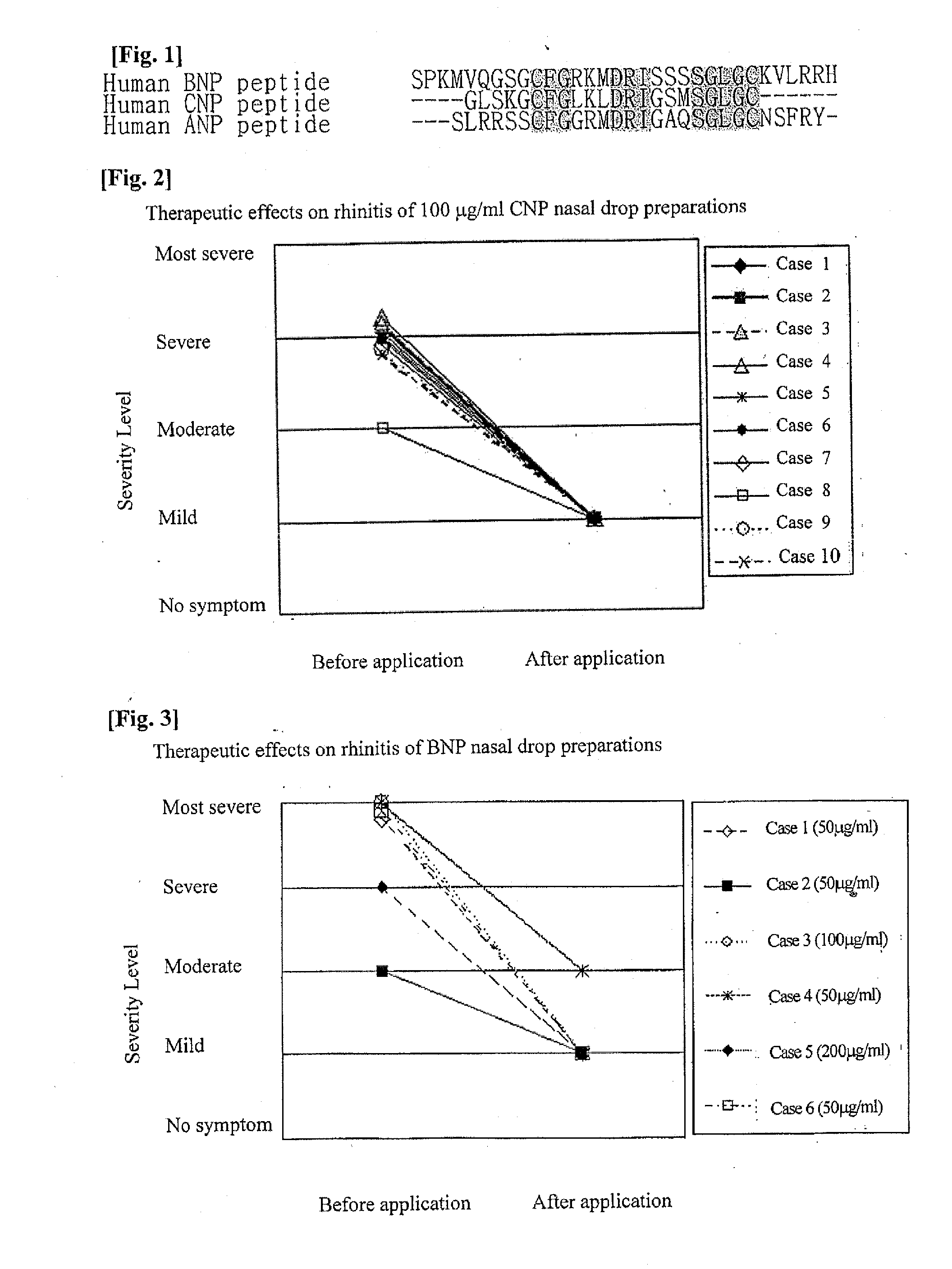 Therapeutic agent for rhinitis