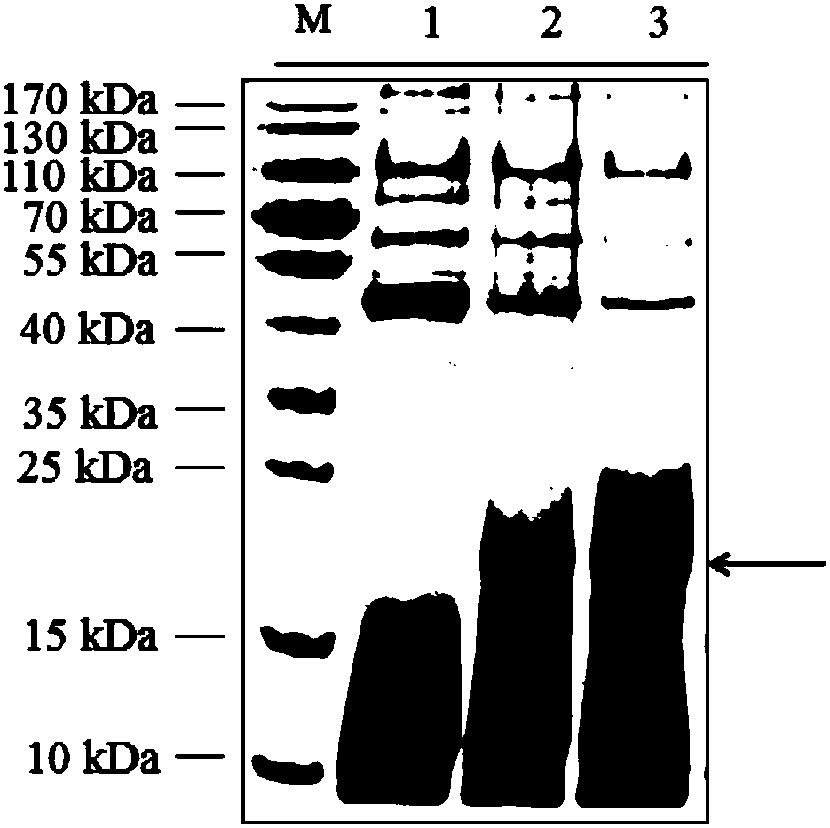 Expression and application of thymosin-repeated protein Cq-TRP1 resisting WSSV (White Spot Syndrome Virus) infection in pichia pastoris