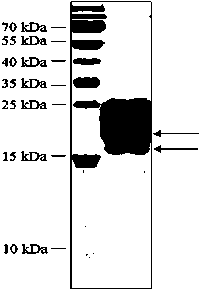 Expression and application of thymosin-repeated protein Cq-TRP1 resisting WSSV (White Spot Syndrome Virus) infection in pichia pastoris