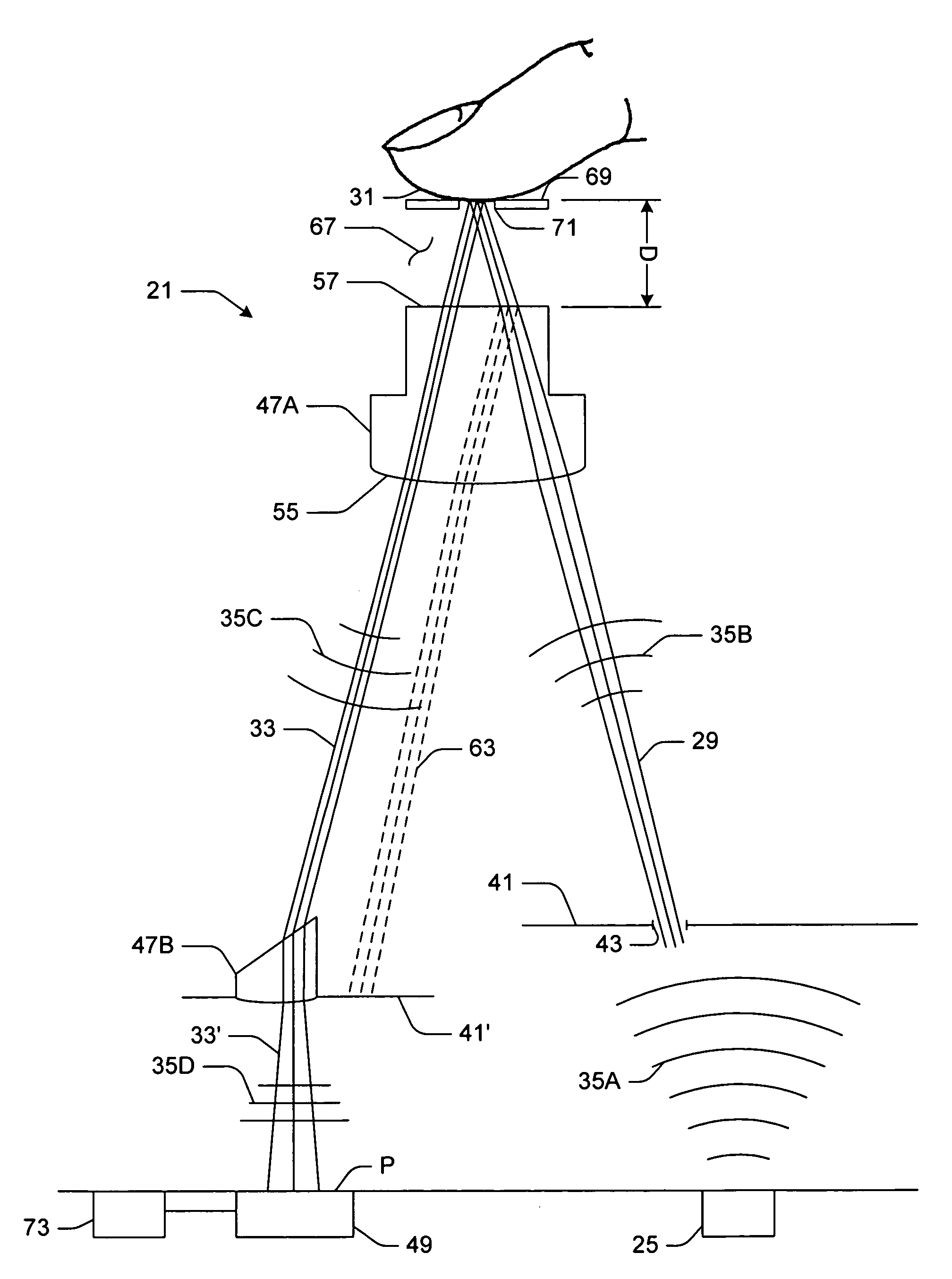 Data input devices and methods for detecting movement of a tracking surface by a laser speckle pattern