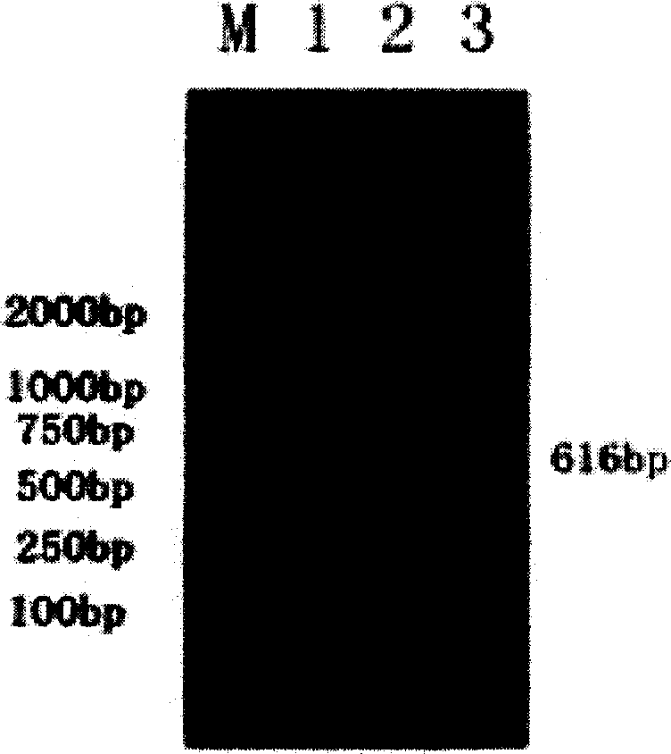 Kit for diagnosing gene of pathogenic bacterial and river vibrion of aquatic animal and human and testing method thereof