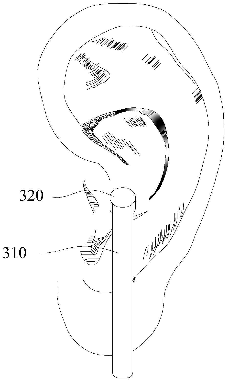 Clamping type ear-wearing device