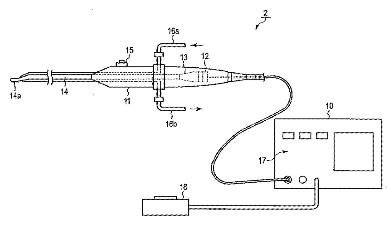 Method for replacement althroplasty