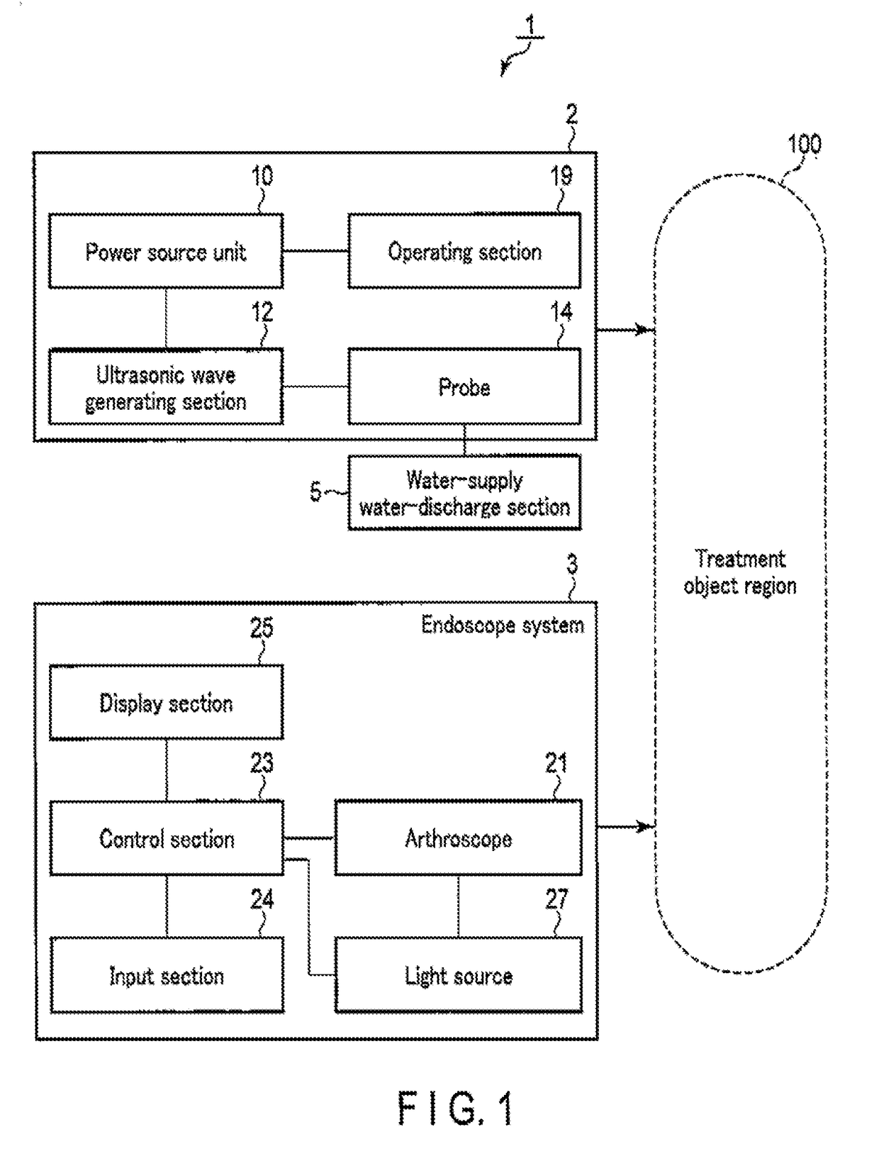 Method for replacement althroplasty