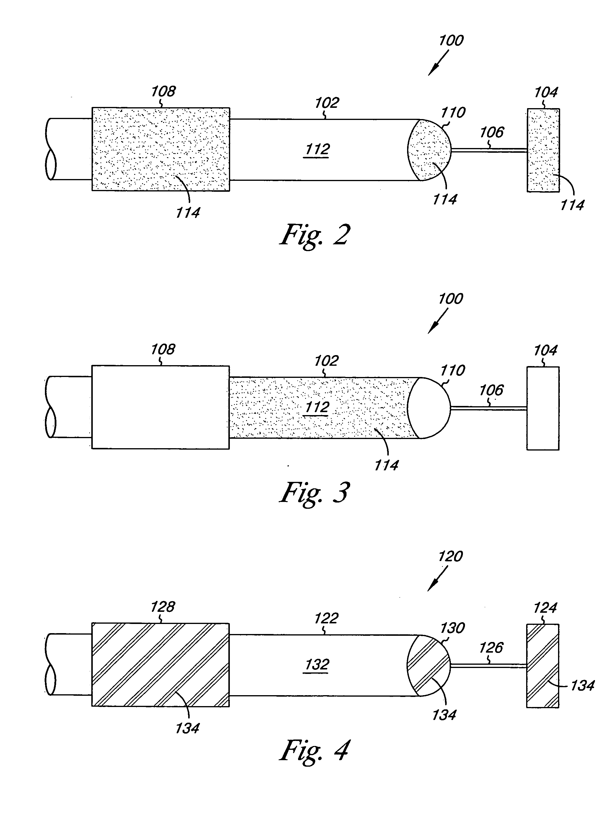 Absorbable myocardial lead fixation system