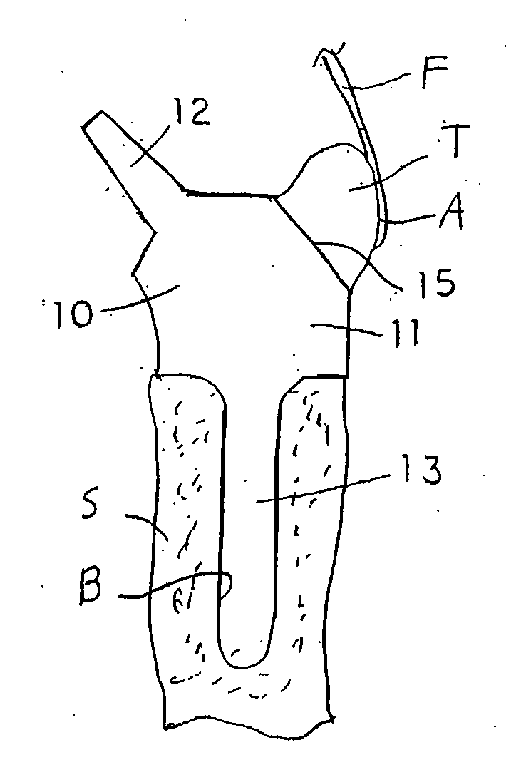 Soft tissue attachment system and method