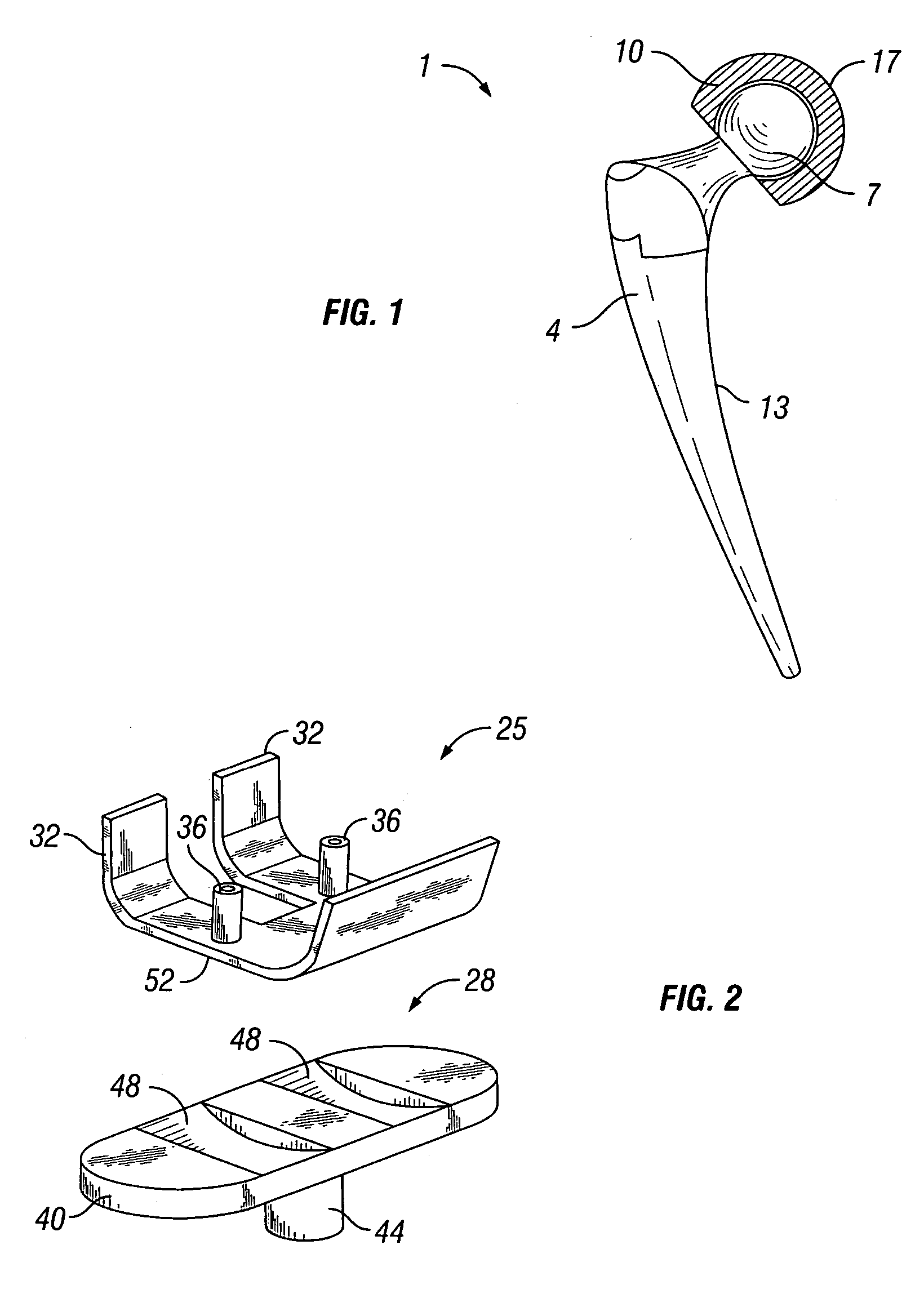 Plasma sprayed porous coating for medical implants