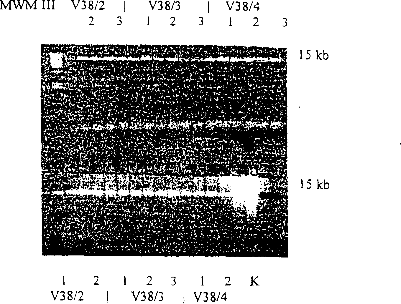 Enzyme reaction method for nucleic acid and composition for separating nucleic acid