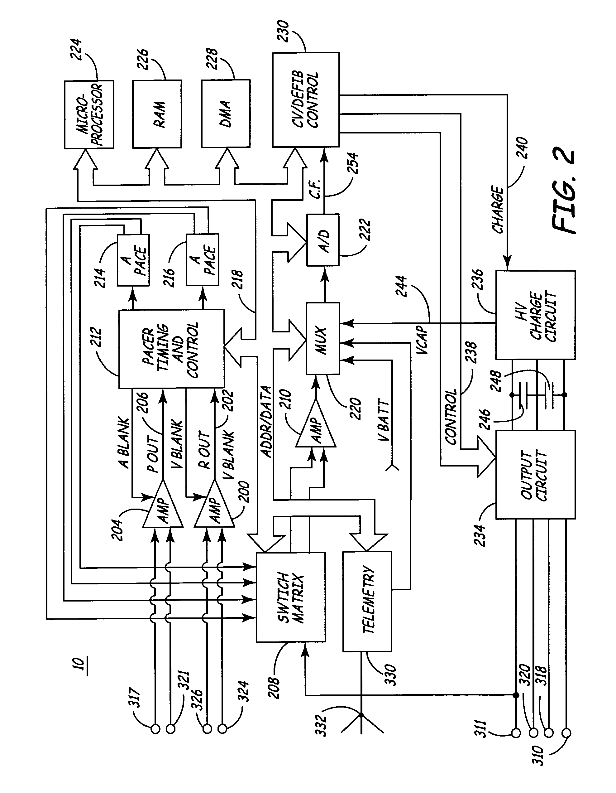 Dual chamber method and apparatus for diagnosis and treatment of arrhythmias