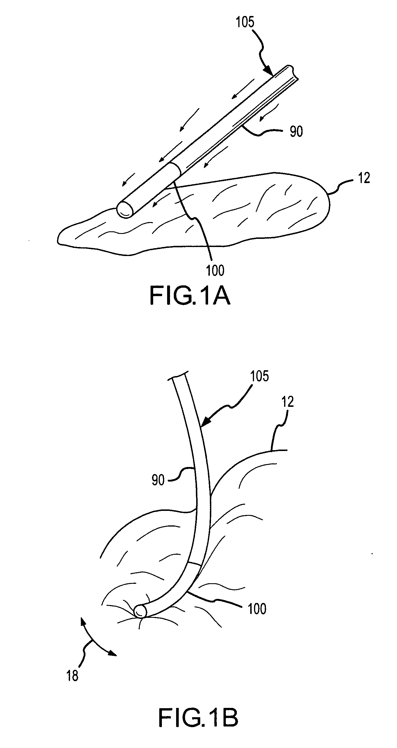 Pressure-sensitive conductive composite electrode and method for ablation