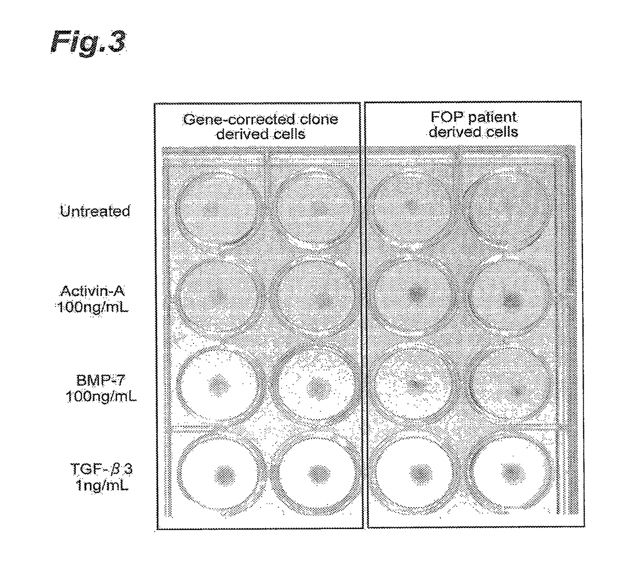 Prophylactic Agent and Therapeutic Agent for Fibrodysplasia Ossificans Progressiva