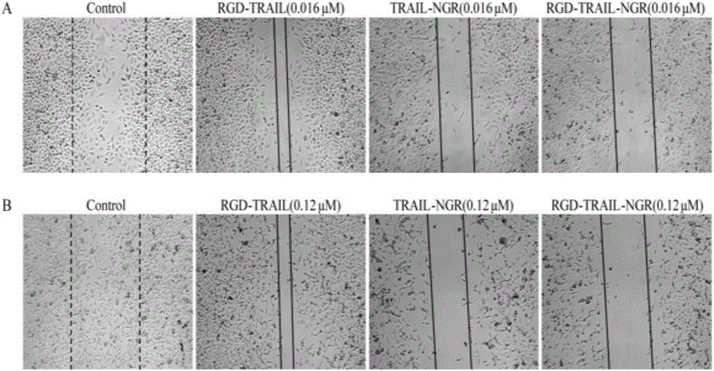 Preparation of multiple-target fusion protein resistant to tumor invasion and metastasis and application of multiple-target fusion protein