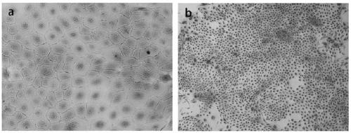 Isolated culture method of hair follicle stem cells of Yangtze River delta white goat