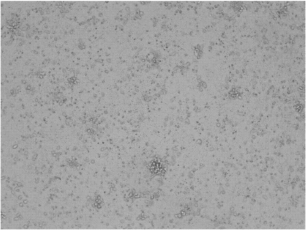 Culture method for Schwann cells